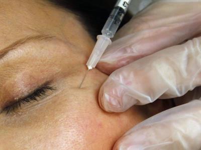 Alerta de las autoridades estadounidenses sobre la presencia de bótox falsificado en inyecciones