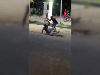 Mutilación: mano de hombre en SPM no pudo ser salvada por médicos