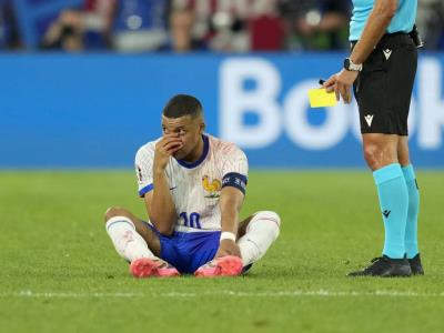 Lesión de Mbappé en la nariz durante el partido resulta en victoria para Francia