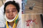 Piden ayuda para mujer golpeada con un martillo en una bodega de El Bronx