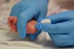 Fibrosis quística, una de las enfermedades que es posible detectar con el tamizaje neonatal