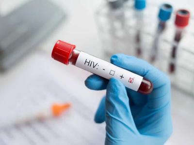 Desarrollan una nueva vacuna llamada lenacapovir para prevenir el Virus de Inmunodeficiencia Humana (VIH)