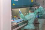Comité de expertos respalda la aprobación un nuevo medicamento contra el alzhéimer en EEUU