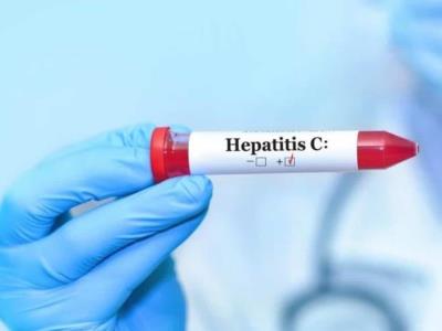 Se otorga precalificación al primer autotest para detectar la hepatitis C