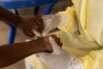 El Gobierno de Venezuela activa un plan de vigilancia epidemiológica contra la mpox