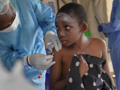 Mpox suma al menos 19,000 casos en África