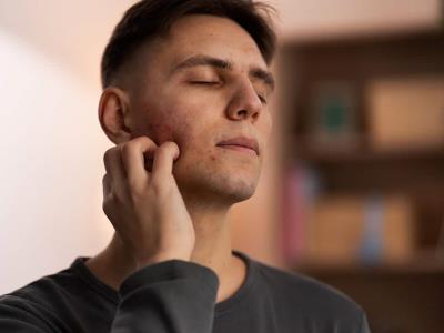 10 mitos y verdades sobre el lupus