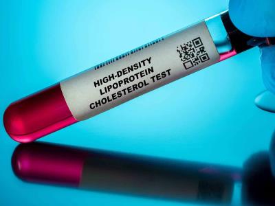 ¿Qué tan peligrosa es una lipoproteína (a) elevada