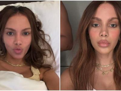 Anitta sorprende al reaparecer con nuevo rostro