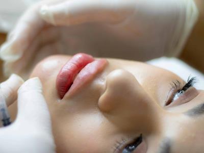 Aumento de labios: mientras más natural, mejor