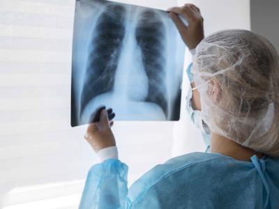Sarcoma: El cáncer silencioso que ataca tejidos y huesos