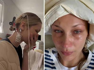 Bella Hadid preocupa a seguidores con fotos desde hospital